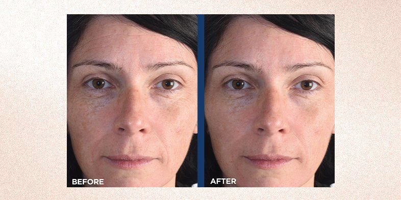 In-Article-best-anti-aging-cream_2